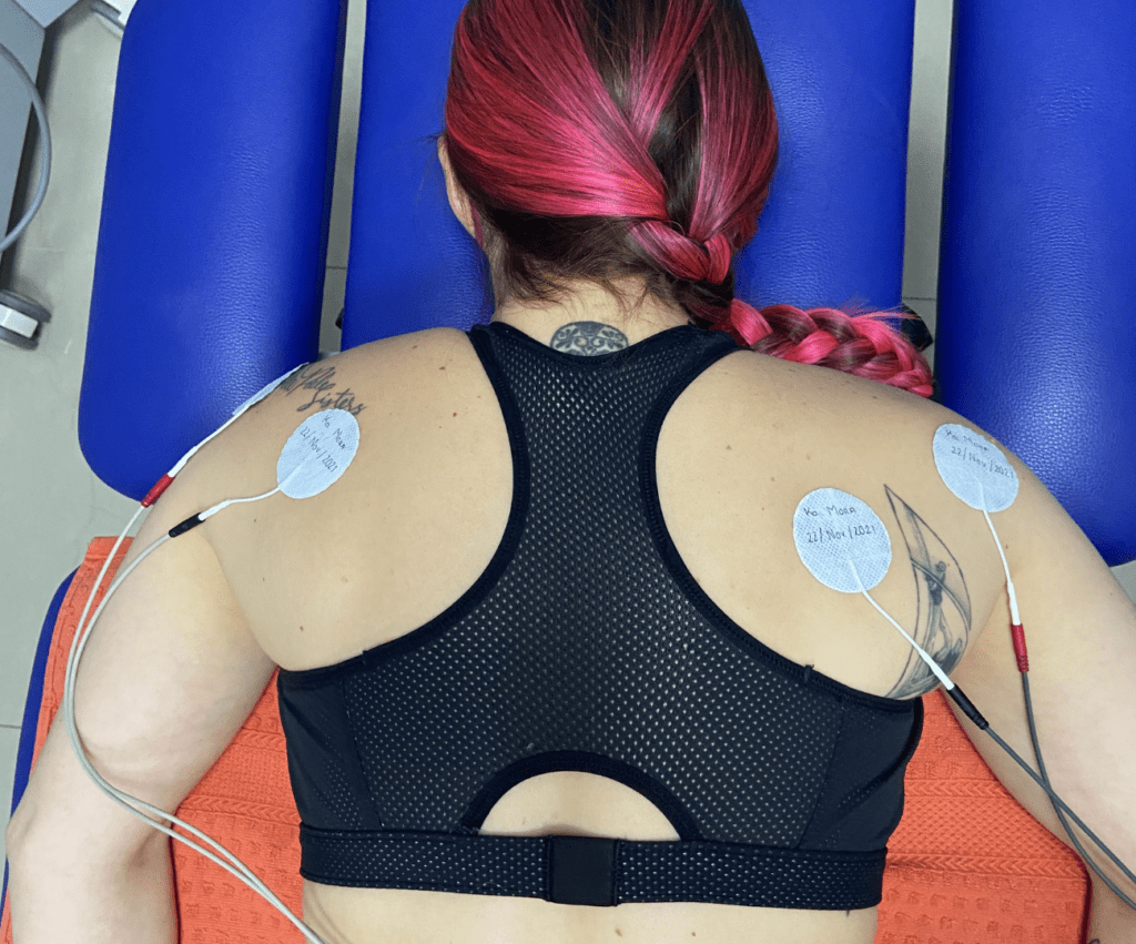 electroterapia en fisioterapia